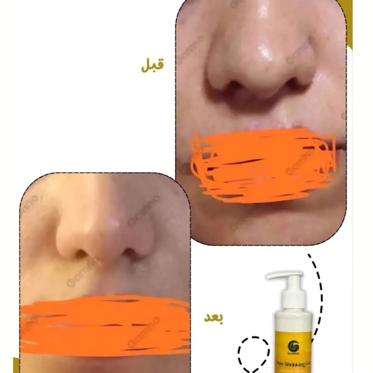 ژل کوچک کننده بینی گامنو مخصوص بینی های گوشتی