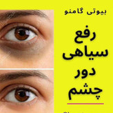 کرم دور چشم گام