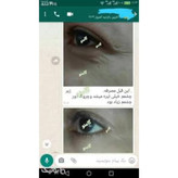 کرم دور چشم گام